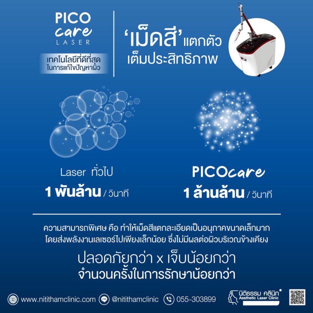 เลเซอร์ลบรอยสัก Pico Laser คืออะไร และประสิทธิภาพในการลบรอยสักเป็นอย่างไร