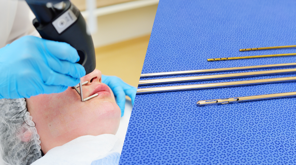 เลเซอร์หลุมสิว vs ตัดพังผืดหลุมสิว แตกต่างกันอย่างไร ?